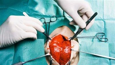 سبق طبي في جهة طنجة… نجاح عملية جراحية لاستبدال صمامّين في القلب