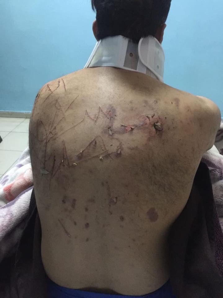 اختطاف الأمين العام لمؤسسة “مؤمنون بلا حدود” وتعذيبه وتهديده بالكتابة على ظهره بالسكين