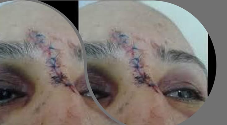 أمن الدار البيضاء يتفاعل مع صورة ضحية اعتداء “شنيع” ويكشف هوية المعتدي