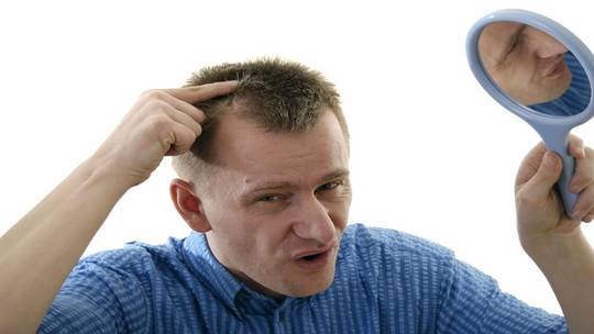 خبراء…القهوة لمكافحة الصلع