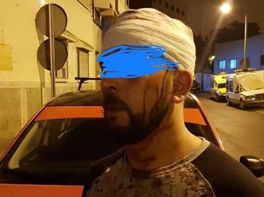 وجدة. سائق سيارة أجرة صغيرة يتعرض لاعتداء “شنيع”