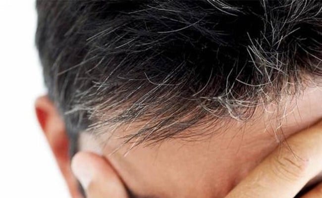 خطوات بسيطة” تؤخر زحف الشيب على شعرك