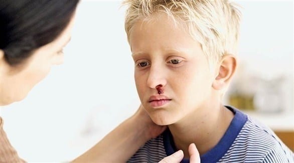 نزيف الانف..سبابه وكيفية مواجهته لدى الأطفال