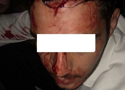 إسبانيا. اعتقال ابن ملياردير مغربي بتهمة الضرب والجرح