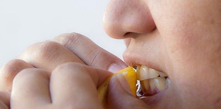 قشر الموز..طريقة استعماله لاسنان بيضاء لامعة