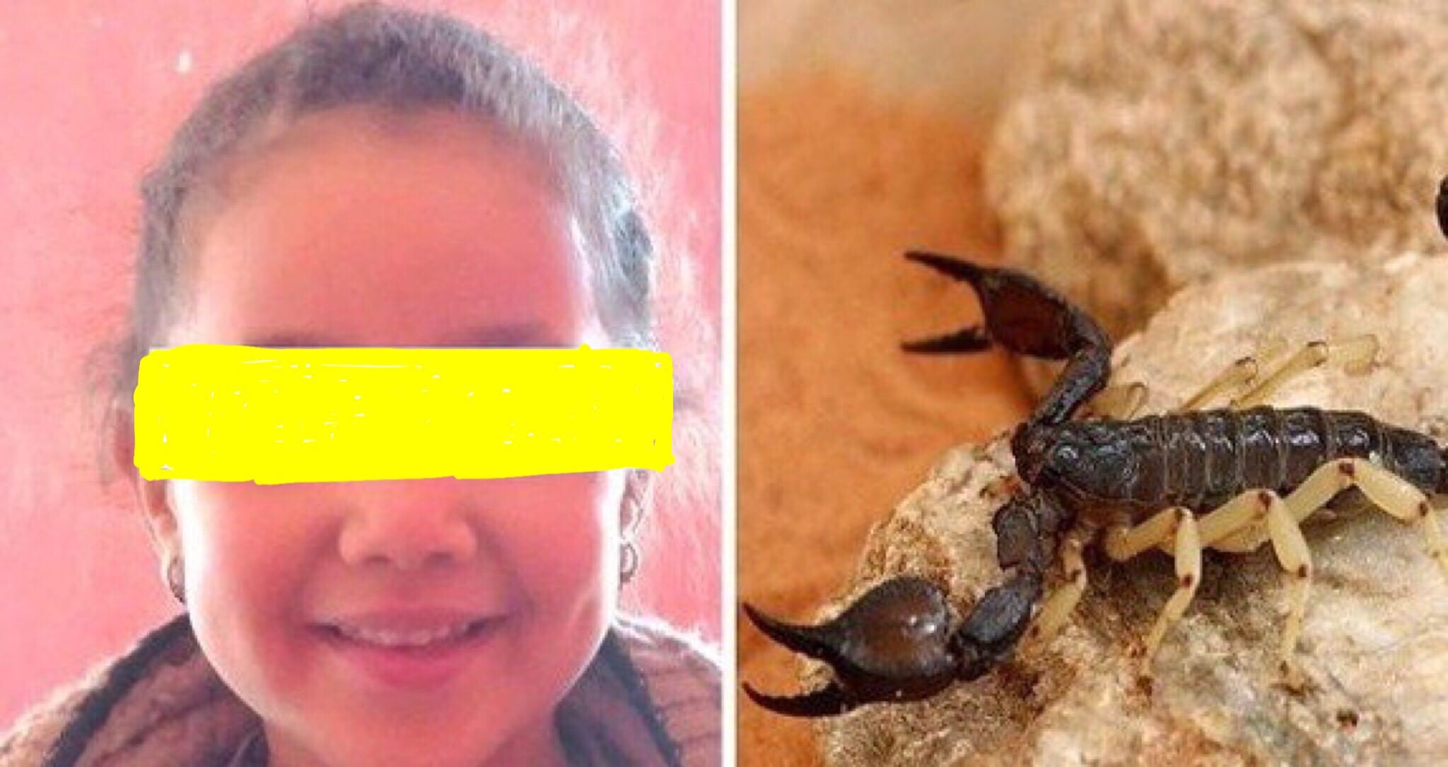 ويتواصل الاستهتار.. وفاة طفلة في شيشاوة بلسعة عقرب وغياب الأمصال