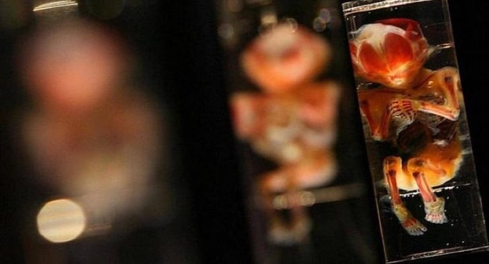 هادا كنْ ما مات كن نقارضو الميريكانْ. وفاة طبيب تكشف ألفين و200 جنين ميت داخل منزله