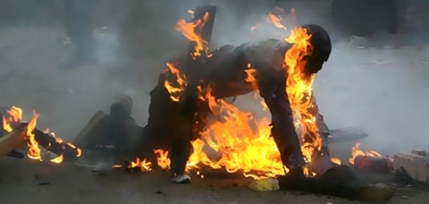 الداخلة. نقل “مختلّ” أحرق نفسه إلى مستشفى بمراكش في حالة حرجة