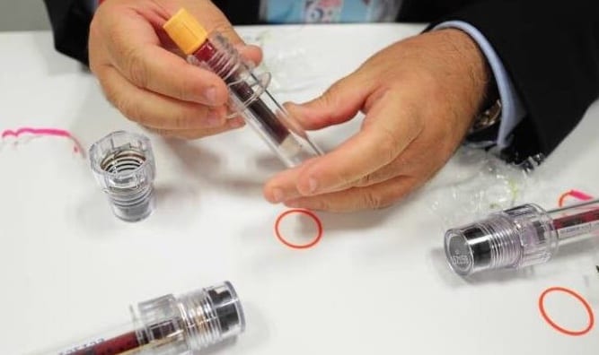 طريقة جديدة لاختبارات المنشطات في أولمبياد طوكيو 2020