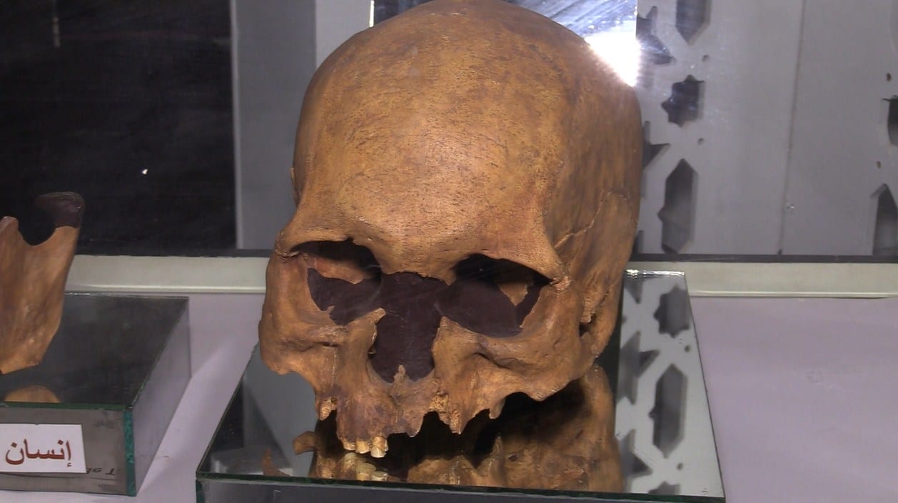 شاهد بالفيديو. جمجمة &quot;إنسان تافوغالت&quot; صاحب أقدم عملية جراحية في العالم |  Le12.ma