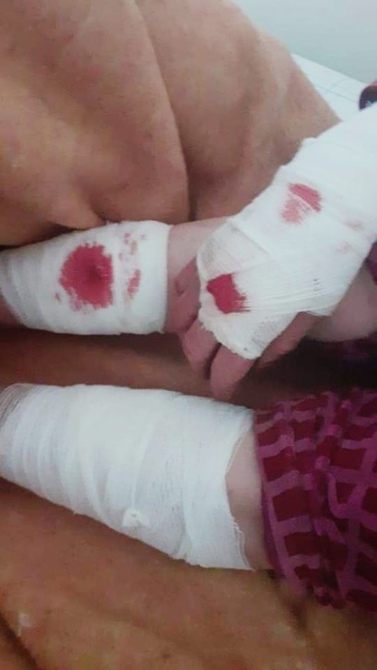 سيدي إفني. الحلّوف يرسل شخصين إلى المستعجلات