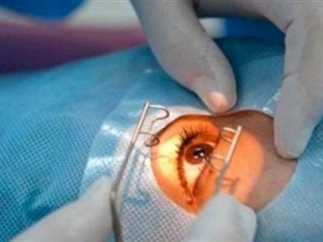 تحذير طبي.. اوقفوا جراحة العيون ‘الليزك” نهائيا