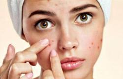 “بلازما الدم”.. تقنية تجميلية لمحو آثار حب الشباب