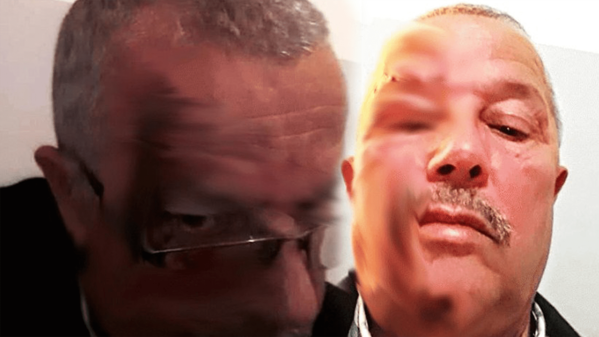 الناظور. إعتداء “عنيف” على مدير مؤسسة تعليمية والأمن يوقف المعتدي