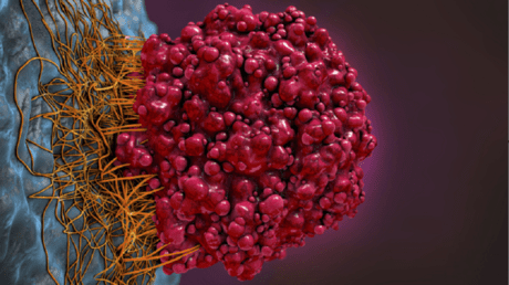 ردوا بالكم. التعرق ليلا قد يكون علامة تحذيرية لنوع من السرطان