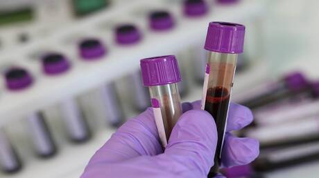 تحليل دم للكشف عن الإصابة بكورونا في خمس دقائق بالولايات المتحدة