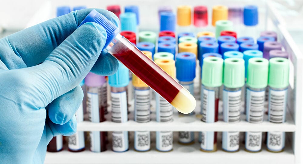 تعرفوا. “الذهب السائل” مفتاح نجاح الاطباء في معركتهم ضد فيروس كورونا