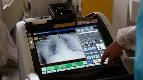 دراسة. اكتشاف “سر” الإصابة بفيروس “كورونا” مرة ثانية بعد الشفاء منه