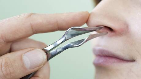 ها علاش. يفقد المصاب بفيروس كورونا حاسة الشم