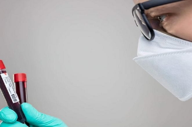 كندا. ارتفاع الوفيات بسبب كورونا إلى 6.637 حالة وفاة