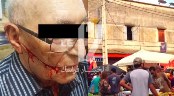 بعدما فتح وجهه . مراهق خرج من السجن ويتحرش بشيخ تجار الخبازات بالقنيطرة