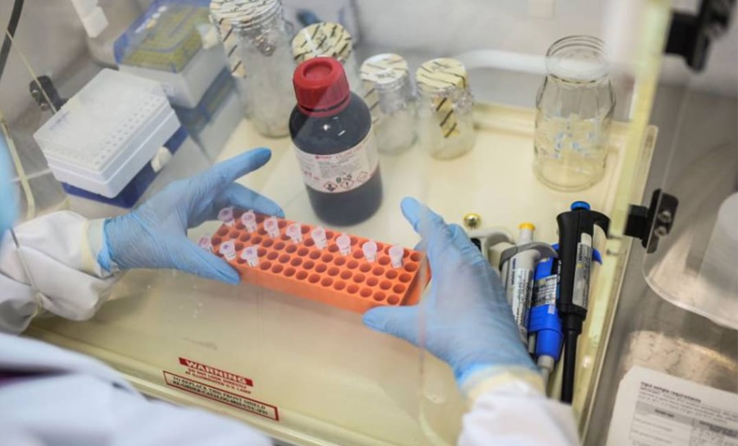 نتائج “مشجعة” لعقار يعالج الروماتيزم في محاربة كورونا