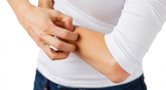 دراسة. الكشف عن خمس حالات جلدية يمكن ربطها بفيروس كورونا