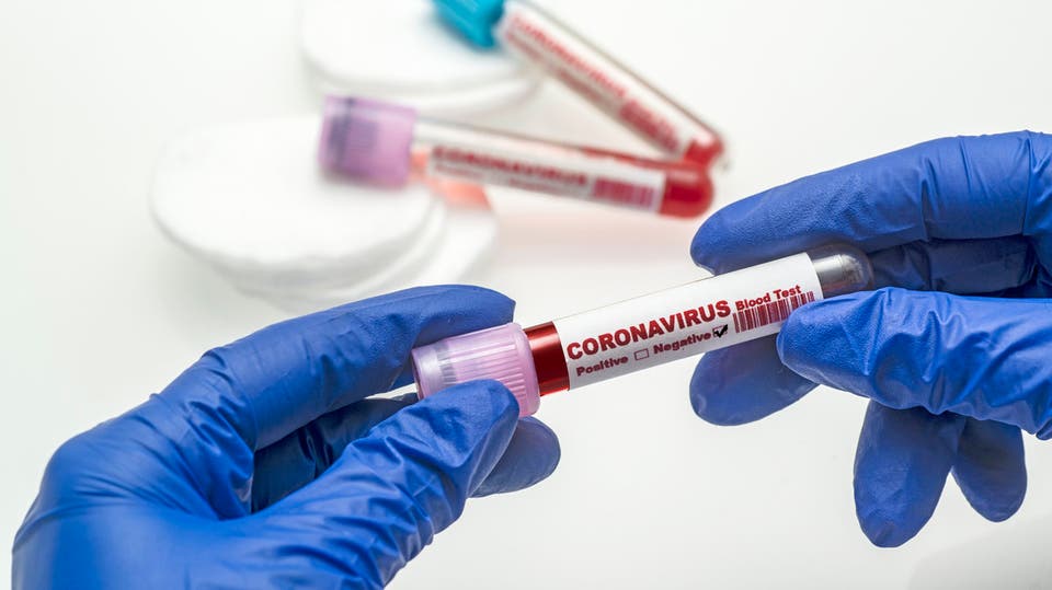 ها علاش. يصاب البعض بكورونا ولا تظهر عليهم الأعراض