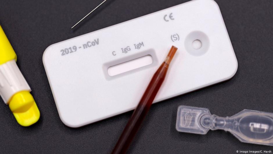 علماء ألمان يطورون اختباراً جديداً لٱكتشاف فيروس كورونا