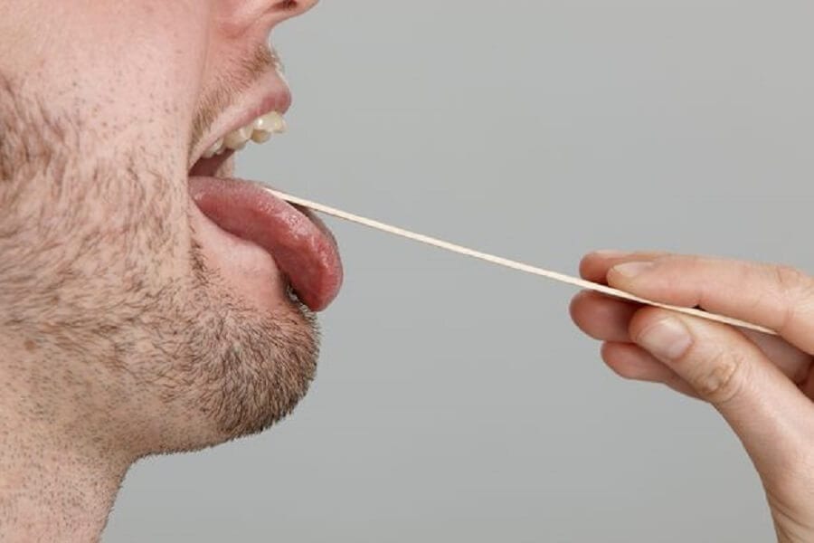 ماذا يُخبرك لسانك عن صحتك؟