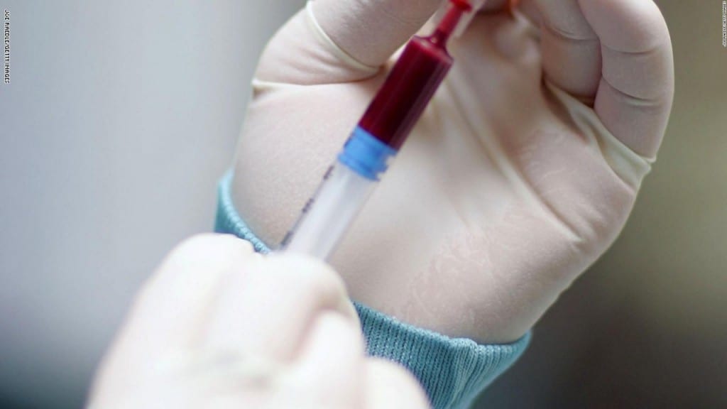 بهذه الطرق البسيطة. يمكن التعرف على فصيلة الدم الخاصة بكم