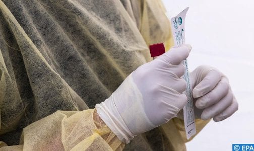 نتائج “مبشّرة” لأولى التجارب البشرية للقاح أكسفورد