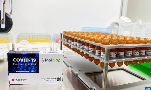مؤسسة “مصير” تشرع في إنتاج أول طقم تشخيص لفيروس كوفيد-19 مغربي 100%