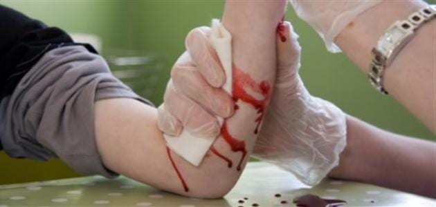 علماء. ابتكار مادة لإيقاف النزيف الحاد بسرعة