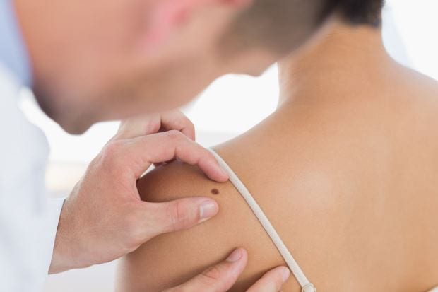 تعرفي عليها.. إكتشاف سبب ظهور البقع على الجلد عند النساء