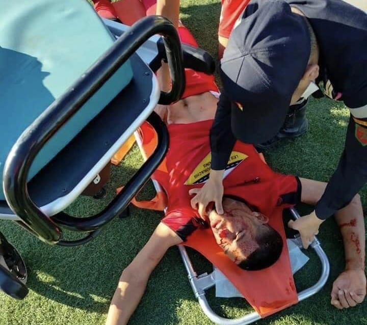 بالصور . اعتداءات همجية على لاعبي الاتحاد القاسمي خلال مباراتهم  أمام مولودية الداخلة