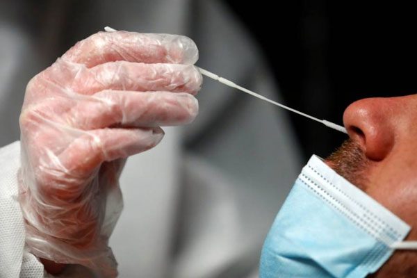 تقنين أسعار الاختبارات الخاصة بكشف فيروس كورونا المستجد