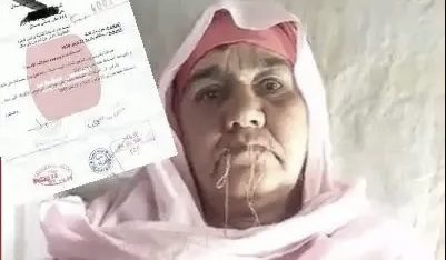 مؤلم.. “مي عايشة” مواطنة كبيرة في السن تخيط فمها احتجاجا على بلدية بني ملال