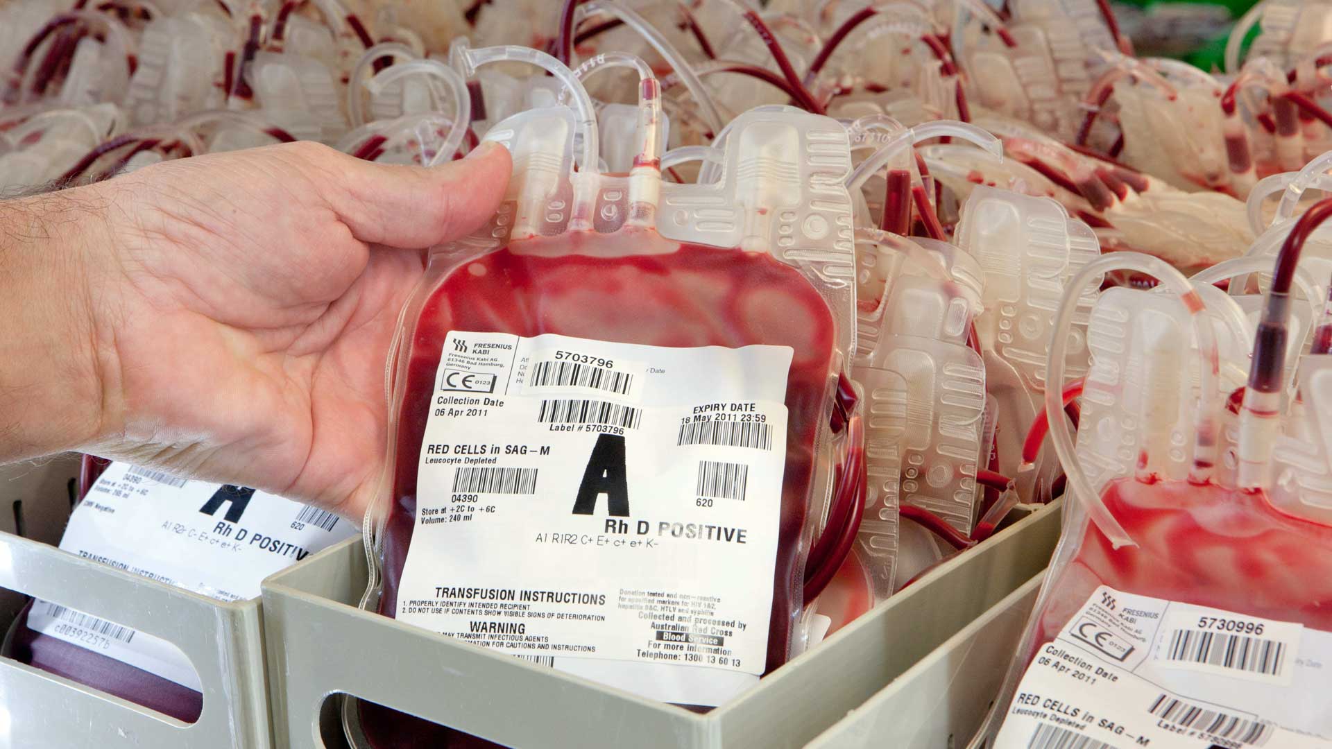 قرب نفاد مخزون الدم يهدد العمليات الجراحية بالمستشفيات المغربية
