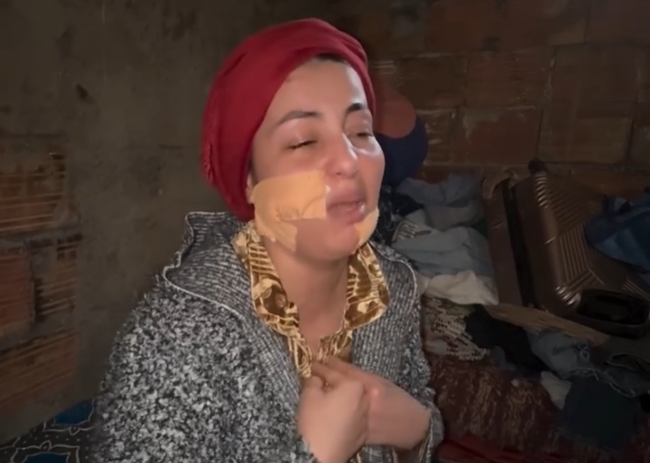 «خديجة القنيطرة». قصة إعتداء تسبب لها في 88 «غرزة» في الوجه وعجز من 35 يوماً