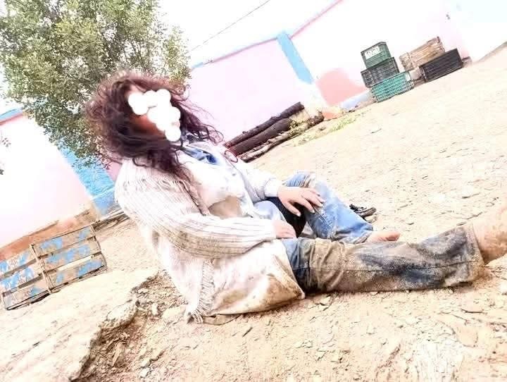 في ليلة عيد الشغل.. سحل أستاذة ضاحية خنيفرة وكسر يد والدتها ( صور)