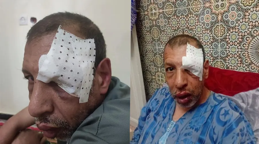 اعتداء أجنبي على شخص من ذوي الهمم يثير غضباً واسعاً في تارودانت