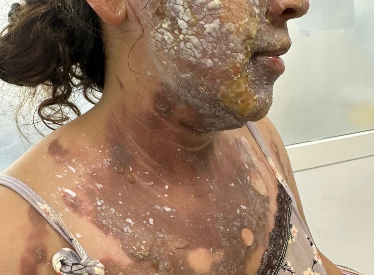 القنيطرة.. مثول مساعدة منزلية أمام الشرطة وسط مساندة حقوقية